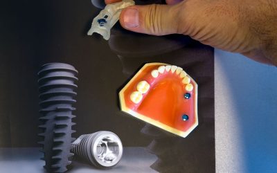 Surgical Guide Nedir? Dijital Çağın İmplantolojideki Devrimi
